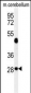 RRAGD Antibody  (Center)